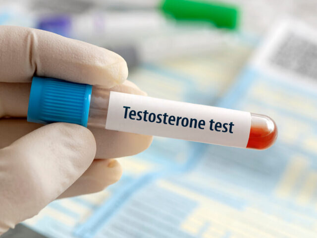 lekarz w białym kitlu pobierający krew z ramienia mężczyzny w jasnym gabinecie